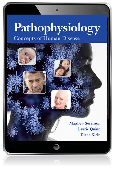 Pathophysiology: Concepts of Human Disease, 1st edition